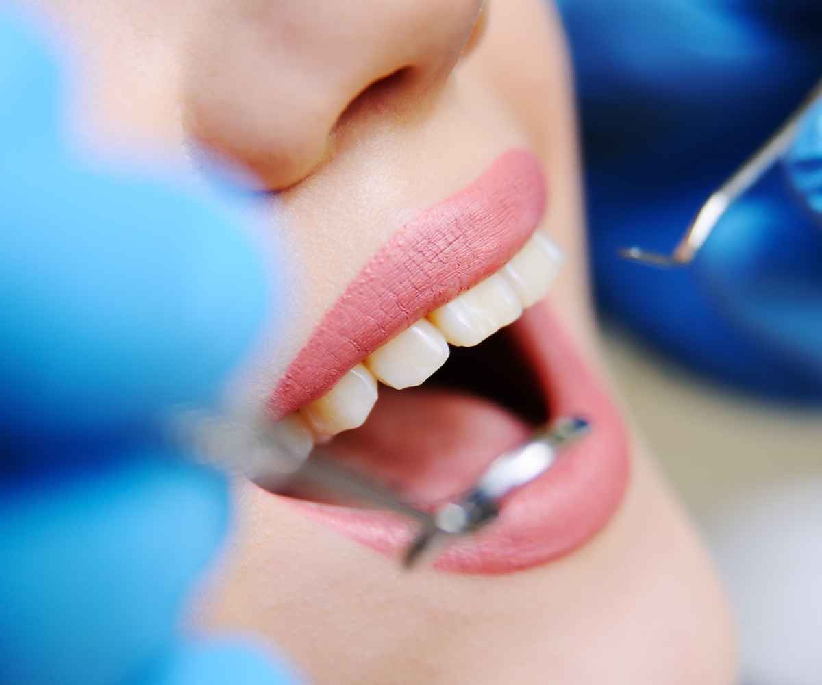 Повязка на зуб в стоматологии